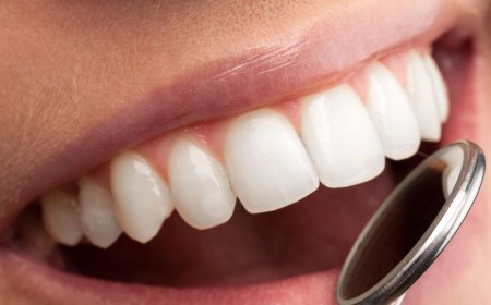 Dental Crowns in Dubai: What to Expect Before, During, and After Treatment