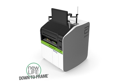 Why More Labs Are Choosing Alinity C for Automated Diagnostics