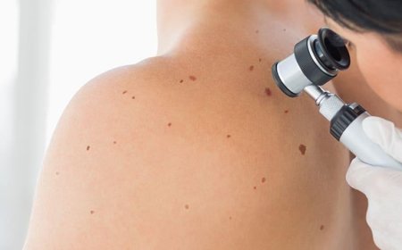 Why Regular Skin Checks Are Essential for Your Health