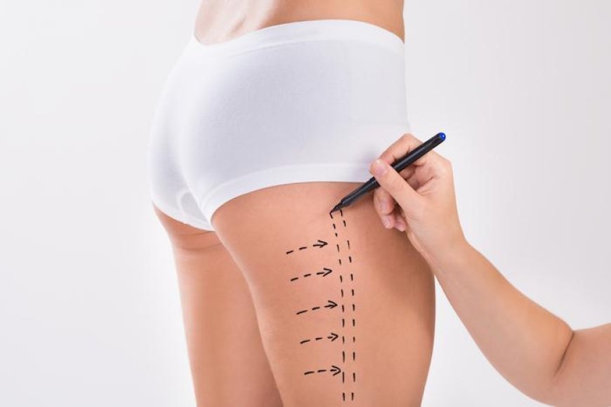 Redefine Your Confidence with Best Liposuction Doctors in Dubai