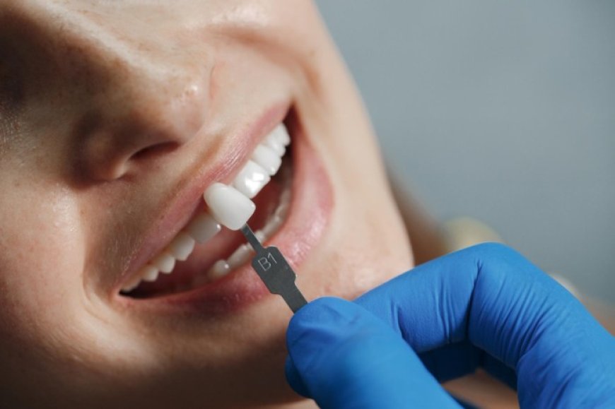 Restore Your Smile Seamlessly with Modern Dental Bridges