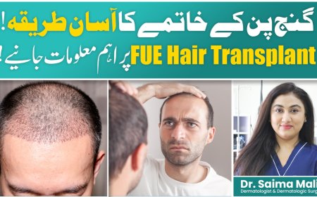 FUE Hair Transplant Explained – Simple Guide for Beginners