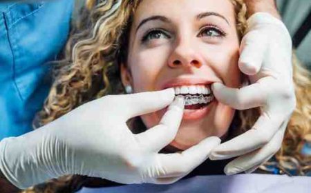 How Intraoral Scanners Improve Your Orthodontic Treatment