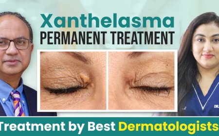 Expert Dermatologist for Xanthelasma | Get Clear Skin Today