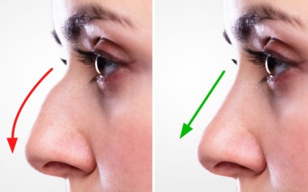 How to Choose the Clinic for the Best Rhinoplasty in Islamabad