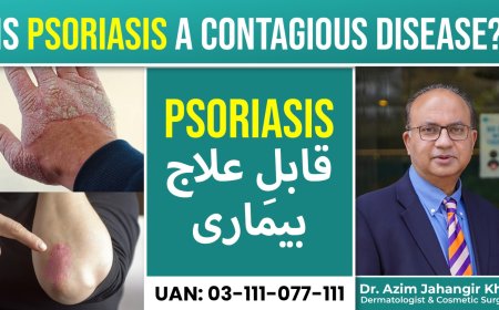 Expert Psoriasis Care in Lahore – Explained Simply
