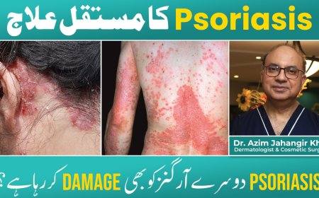 Manage Psoriasis Easily & Effectively