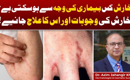 What Causes Itchy Skin? Expert Guide by Institute Cosmetique