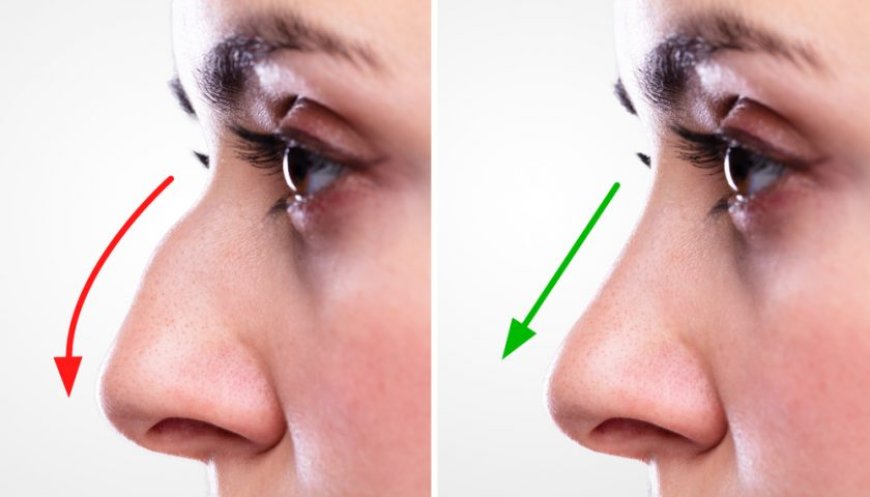 How to Choose the Clinic for the Best Rhinoplasty in Islamabad
