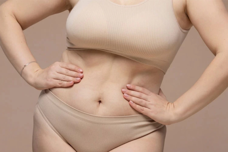 Everything You Need to Know About Tummy Tuck Dubai