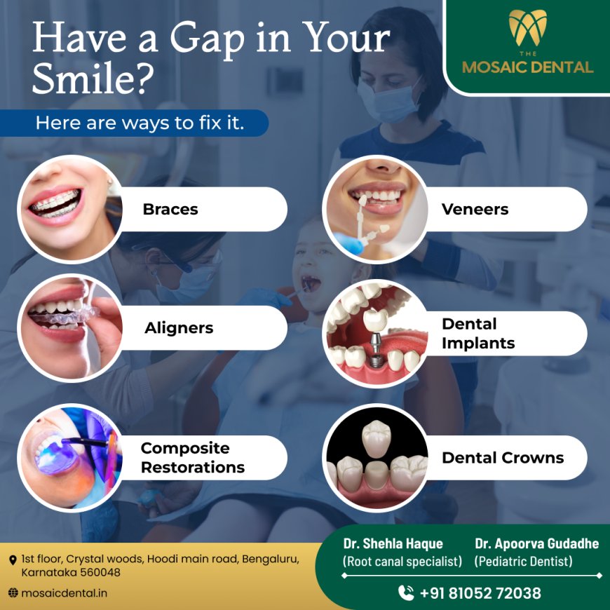 Best Dentist in Hoodi Bangalore: Your Guide to Quality Dental Care